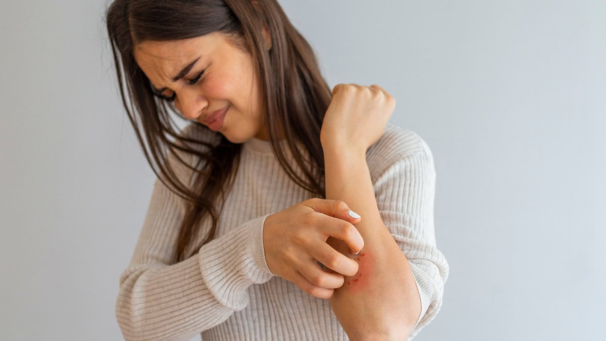 230403 Wdg Psoriasis 2